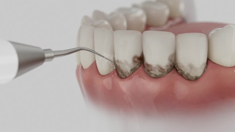 Reliable Dental Implants contractor in Monona, IA by Smile Center Dentistry